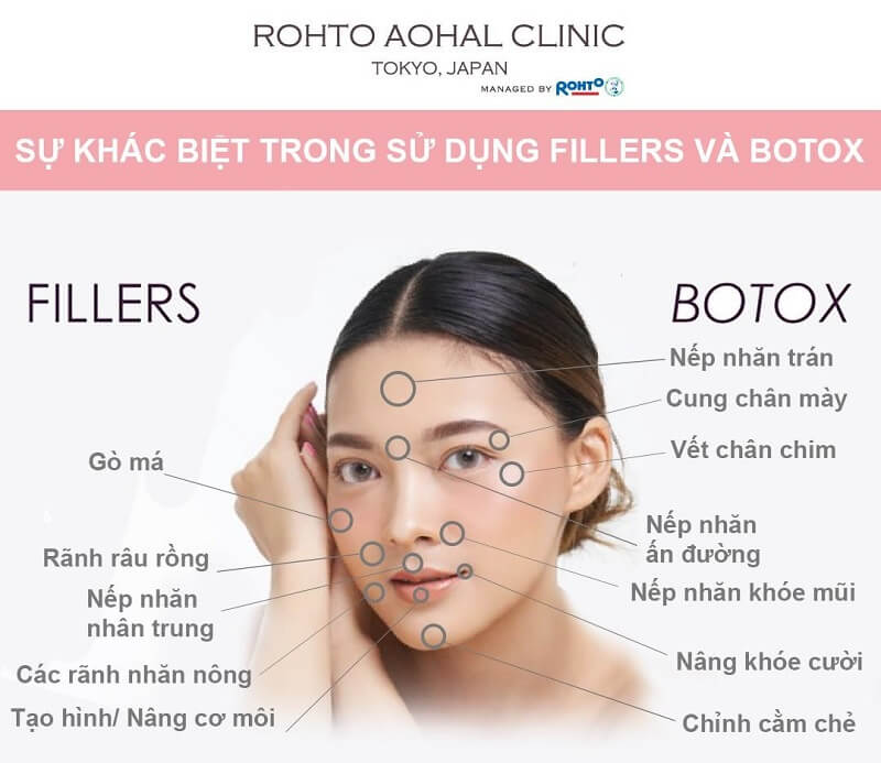 Đăng ký lưu hành filler va botox nhập khẩu