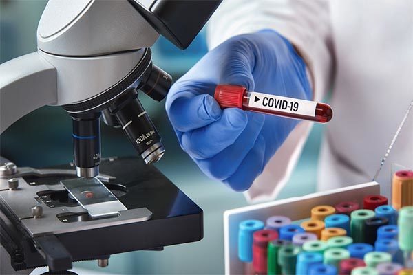 Dịch vụ công bố lưu hành kit xét nghiệm Covid sản xuất trong nước Dịch vụ công bố lưu hành kit xét nghiệm Covid sản xuất trong nước