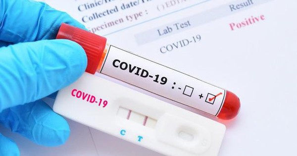 Điều kiện kinh doanh Test Covid Điều kiện kinh doanh Test Covid