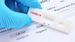 CẤP PHÉP TRONG TRƯỜNG HỢP CẤP BÁCH ĐỐI VỚI TEST NHANH COVID-19 SẢN XUẤT TẠI VIỆT NAM