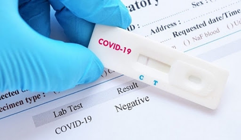 Thủ tục nhập khẩu Test Nhanh Covid 19