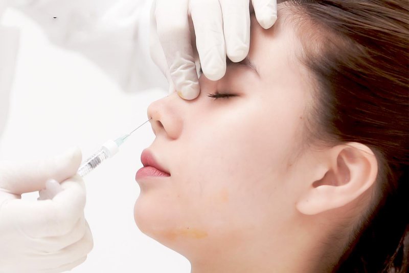 Thủ tục và hồ sơ nhập khẩu chất làm đầy da (filler, bottox) Thủ tục và hồ sơ nhập khẩu chất làm đầy da (filler, bottox)